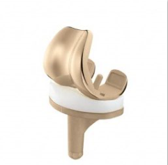 metal allergy knee replacement